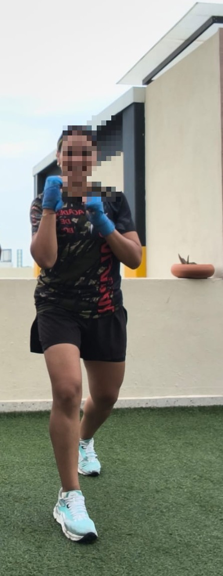Después de cirugía bariátrica en Querétaro