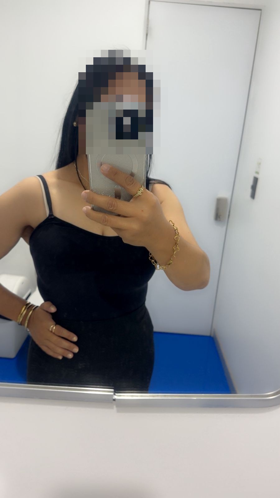 Paciente de cirugía bariátrica en Querétaro — resultado real