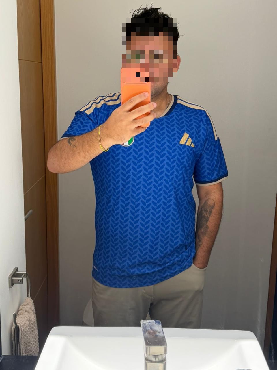 Paciente después de su cirugía bariátrica
