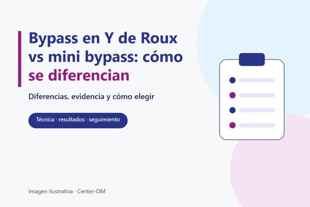 Ilustración con el título Bypass en Y de Roux vs mini bypass: cómo se diferencian