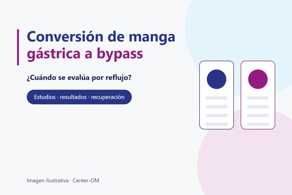 Ilustración con el título Conversión de manga gástrica a bypass por reflujo: ¿cuándo se evalúa?