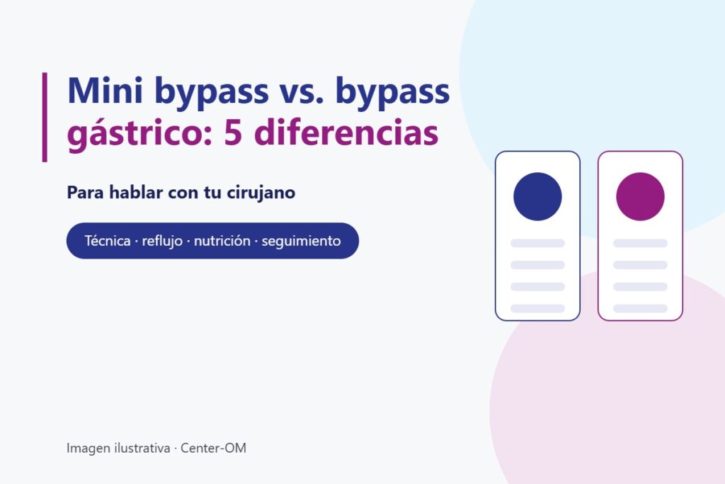 Ilustración con el título Mini bypass vs. bypass gástrico: 5 diferencias para hablar con tu cirujano